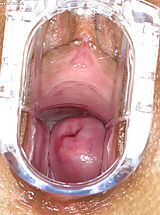 Women Vagina, Incredible Vulva Close Up